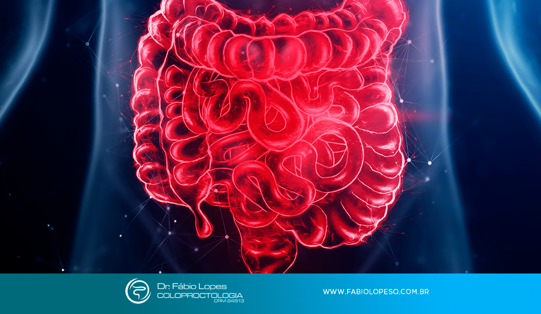 Conheça os principais mitos e verdades nas Doenças Inflamatórias Intestinais