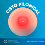 Cisto pilonidal: como identificar e tratar