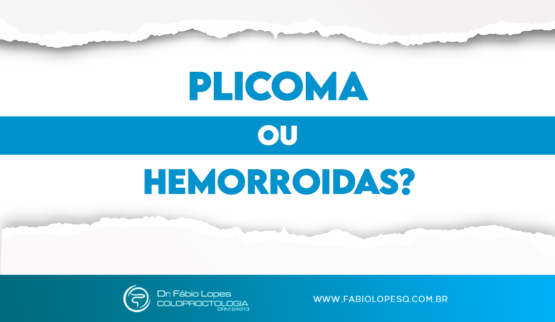 Plicoma ou hemorroidas? Entenda as diferenças entre eles!