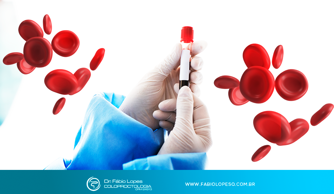 Novo exame de sangue detecta câncer colorretal: mas ele poderá substituir a colonoscopia?