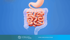 Endometriose intestinal: quando é hora de procurar um coloproctologista?