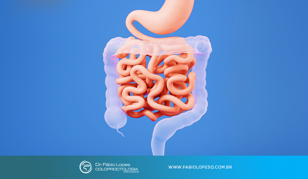Endometriose intestinal: quando é hora de procurar um coloproctologista?