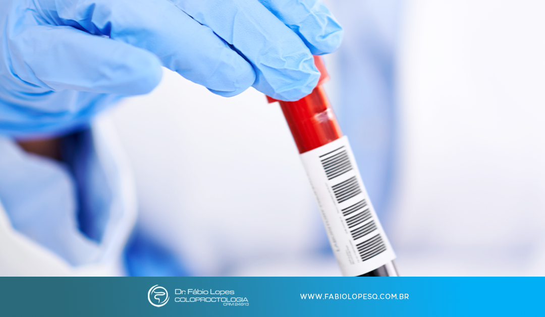 Exames de rastreamento que todo adulto deve considerar