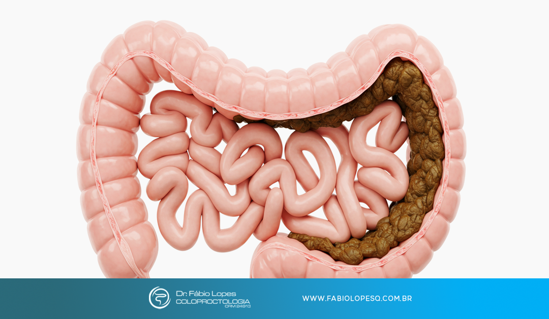 Hábito intestinal saudável: como identificar sinais de alerta nas evacuações