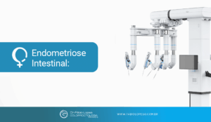 Endometriose intestinal: como a cirurgia robótica está mudando o tratamento e preservando a qualidade de vida da mulher