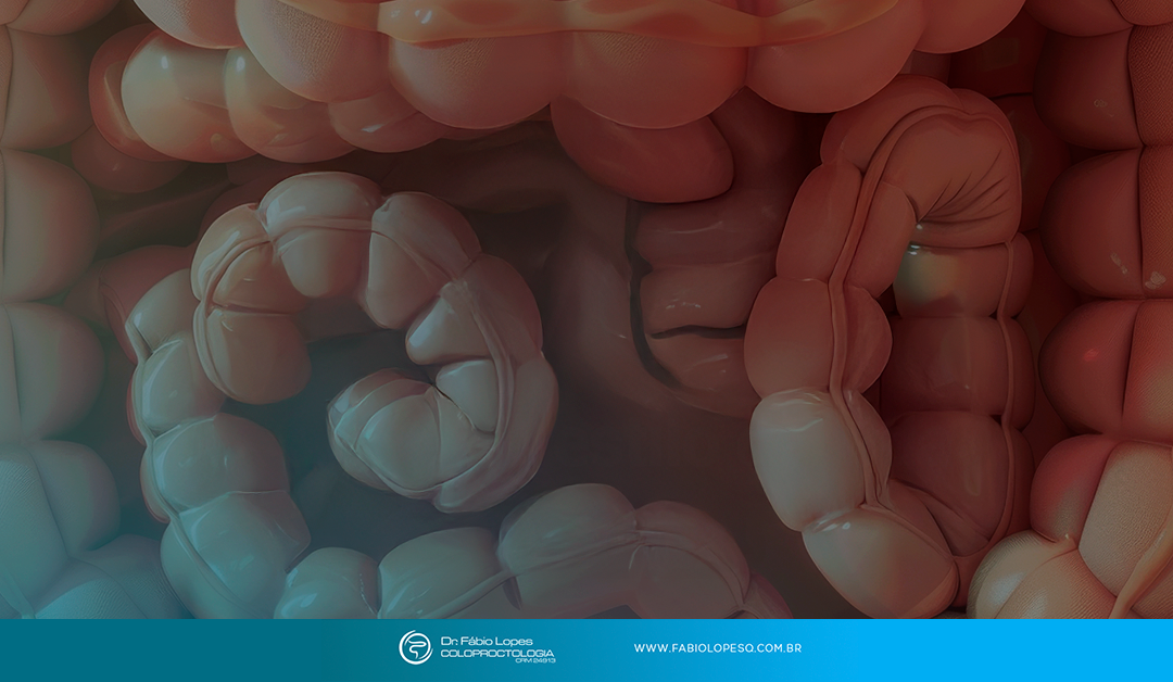 O que o intestino revela sobre seu estilo de vida