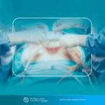 O que acontece durante uma cirurgia de HIPEC?