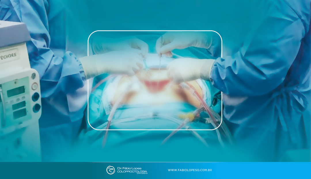 O que acontece durante uma cirurgia de HIPEC?